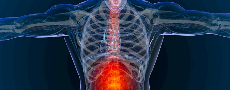 Image depicting a spinal condition